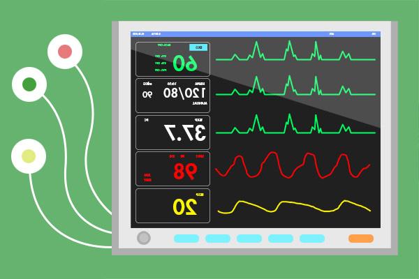 EKG